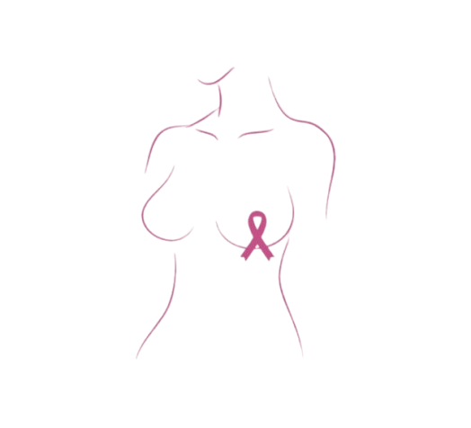 High Risk Breast Check-up