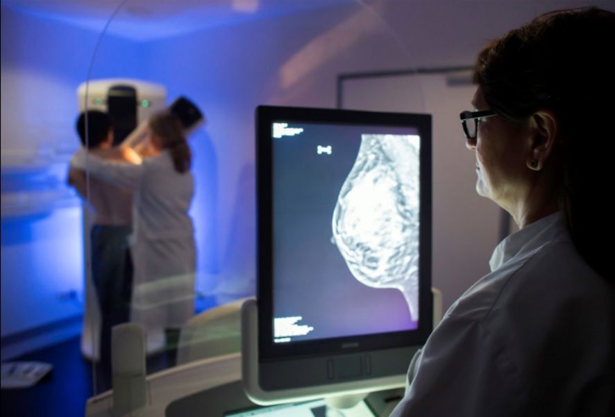 Döş biopsiyası nəticələrini başa düşmək üçün sadə izah