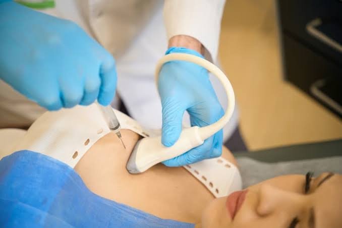 Süd vəzi iynə biopsiyasından sonra nə etməli?